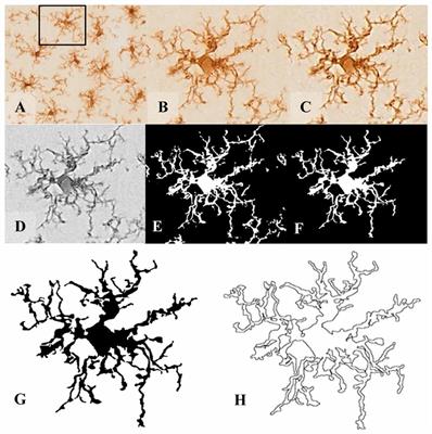 Microglia Morphological Categorization in a Rat Model of Neuroinflammation by Hierarchical Cluster and Principal Components Analysis